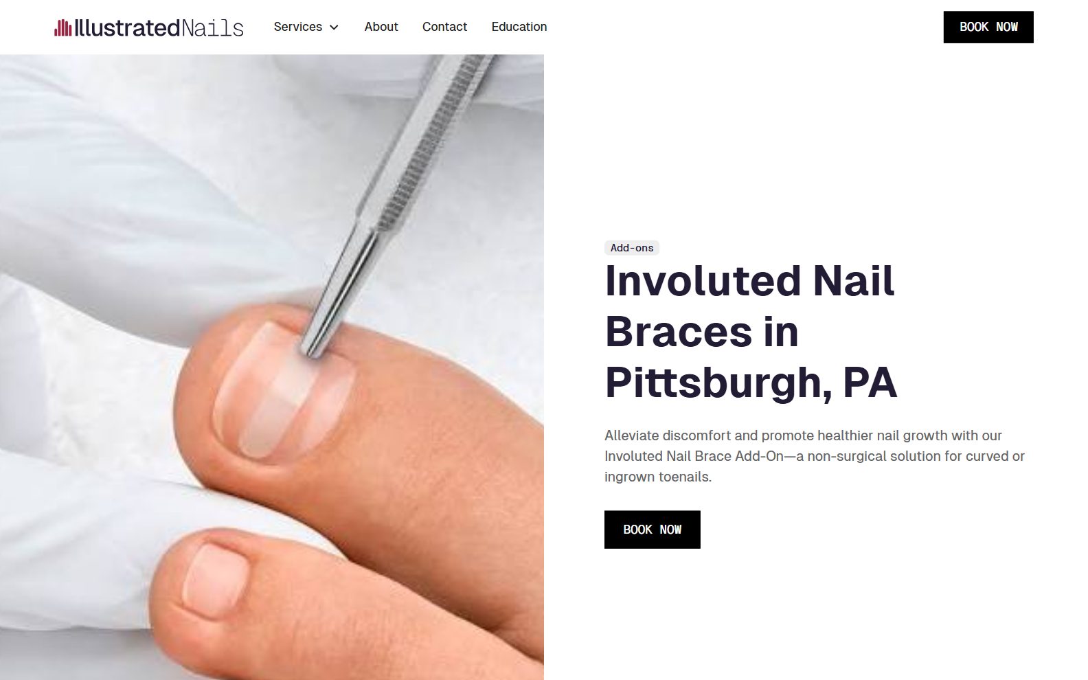 Illustrated Nails Nail Braces